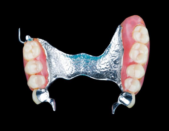 prothèse dentaire amovible mons